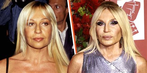 donatella versace no chirurgia|donatella versace looks like.